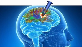 Νέες εξελίξεις στην αντιμετώπιση ογκολογικών και αγγειακών παθήσεων εγκεφάλου.